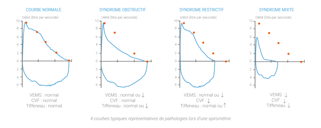 spirometrie tazmalt